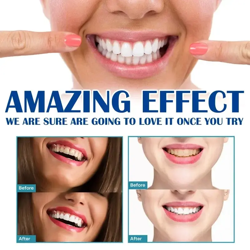 Brightening Dentes Gel Pen, Creme dental de limpeza profunda, Dente Amarelo Remover manchas de placa, Respiração fresca, Higiene Oral, Dental Tool