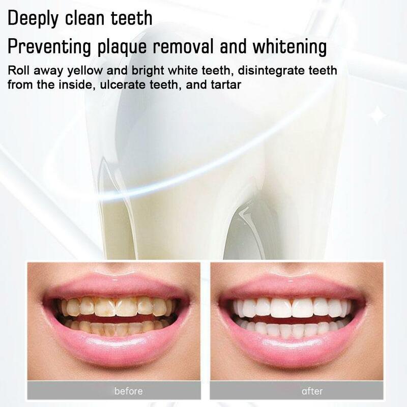 Naprawa próchnicy usuwanie plam z płytki nazębnej wybielająca wybielająca pasta do zębów nowy 2023 żółknięcie zębów naprawa zębów Dec T1B2