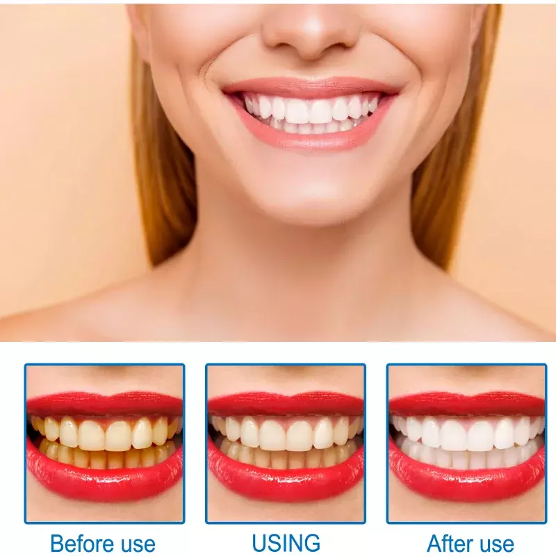 Dentes Whitening Essence, Remover Contra a Cárie Dentária, Manchas de placa, Soro Respiração Fresca, Higiene Oral, Ferramentas de limpeza dentária