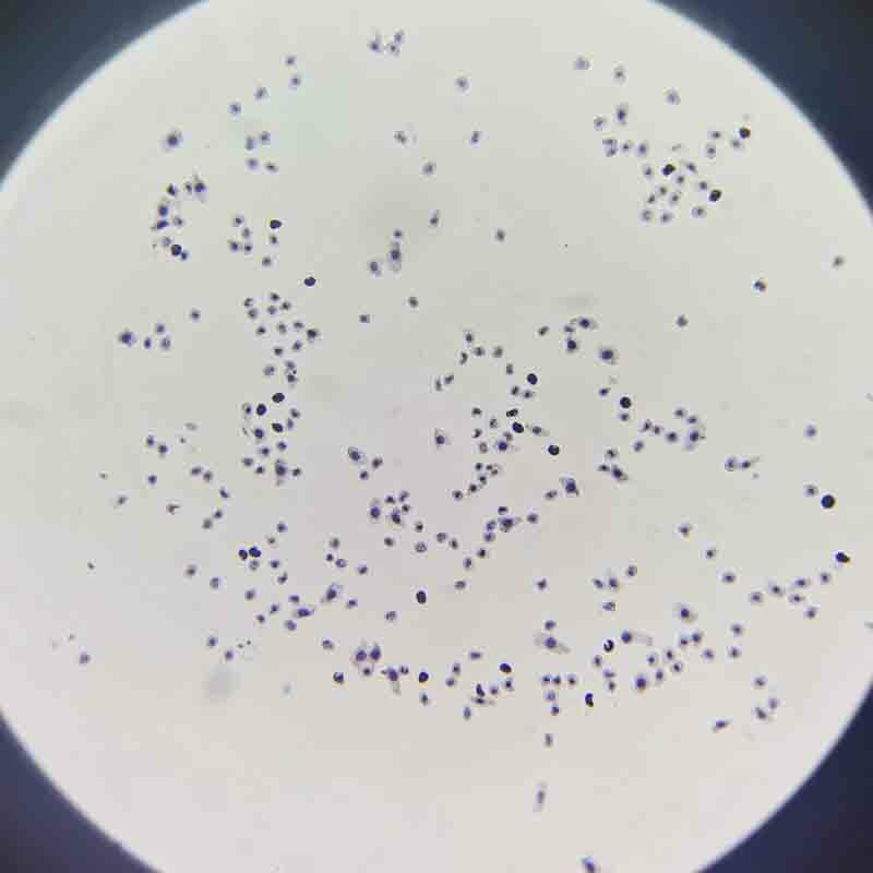 Mitosis-microscopio con toboganes de vidrio, 12 piezas, 5 piezas, punta de raíz de cebolla