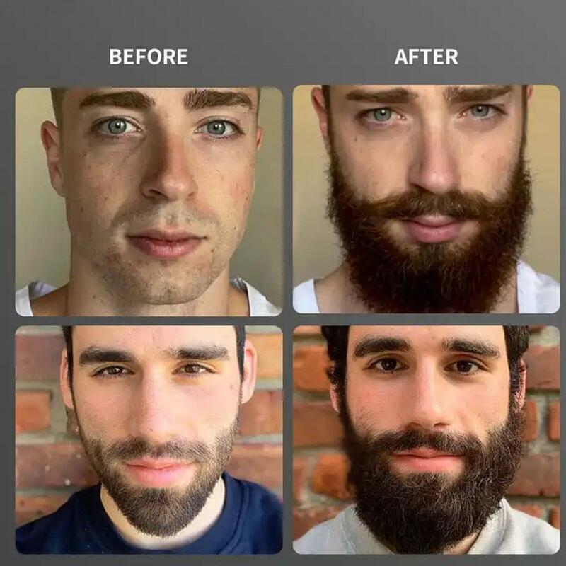 男性用天然あごひげ成長オイル,美容院用親指治療剤,光沢フォームfa z9o5