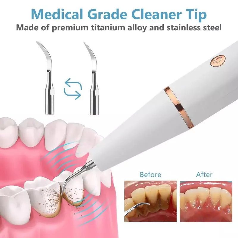 Elektryczny odkamiewacz zębów ultradźwiękowy kamień nazębny do usuwania kamienia nazębnego domowe czyszczenia zębów do polerowania zębów