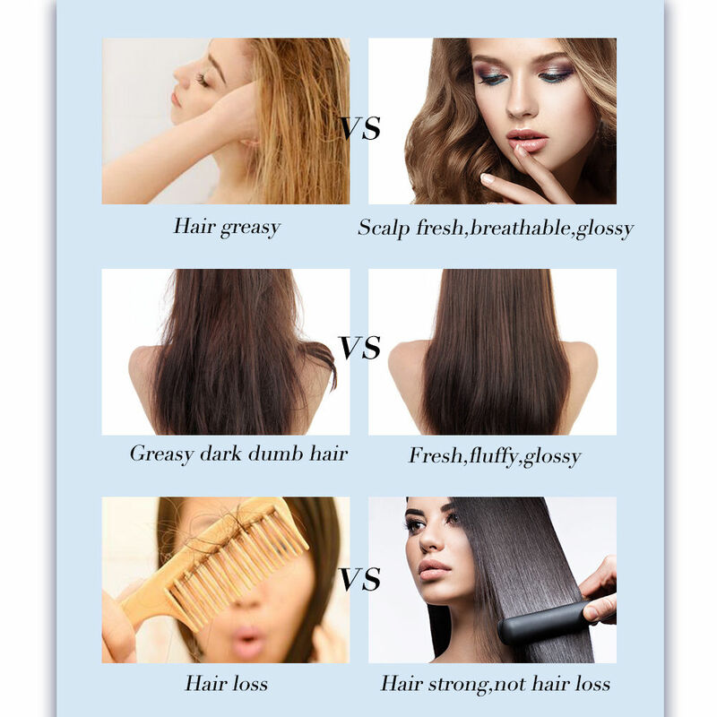 Шампунь для роста волос уход за волосами Кондиционер для выпадения волос лечение для мужчин t сильный корень волос натуральный экстракт шампунь-эссенция для мужчин/женщин и мужчин