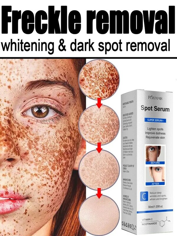 Freckle Removal Whitening Essence Liquid Decompose Melanin Fade Dark Spots Melasma Treatment Brighten Improve Dull Skin Tone 377