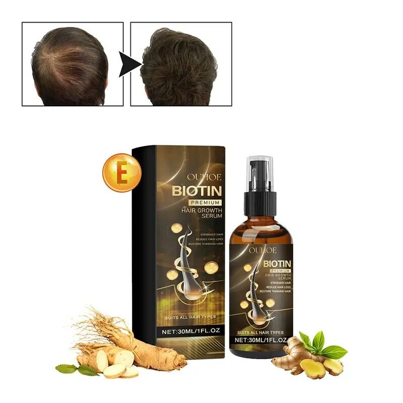 Biotina Óleo essencial para cabelos para homens e mulheres, produtos para cabelos, crescimento rápido, prevenção de perda de cabelo, tratamento do couro cabeludo, J8R1, 30ml