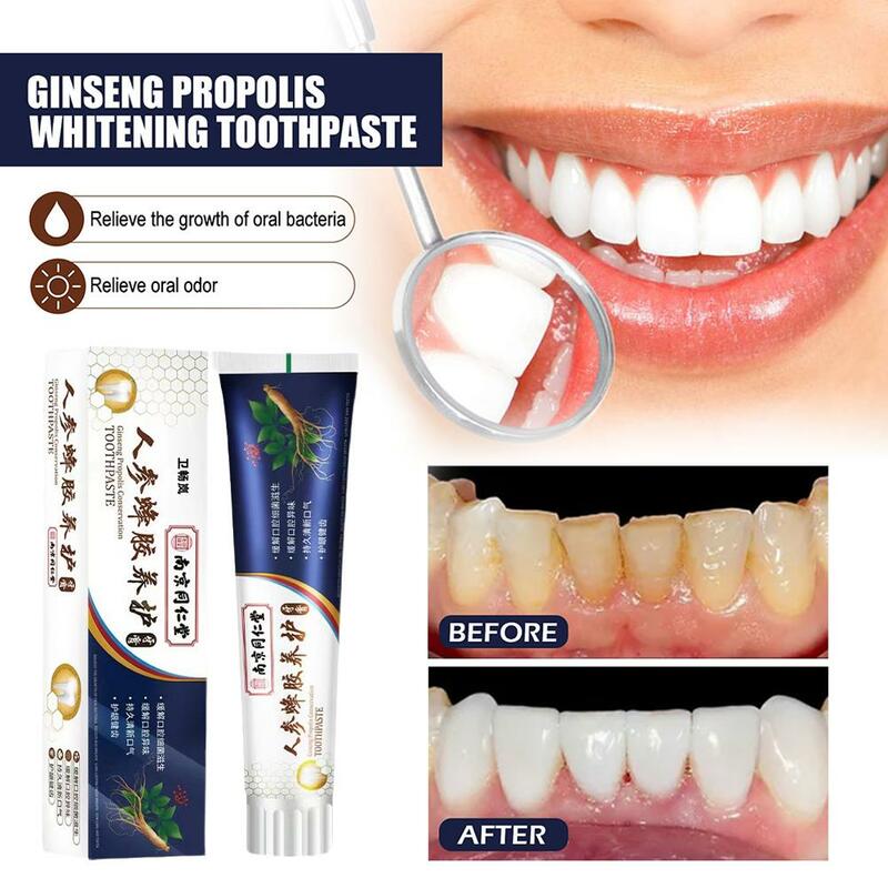 120g Tooth Decay Whitening Toothpaste To Tooth Stains Bad Quick-acting To Yellow Breath Remove Oral Fresh Breath Whitening B6Z3