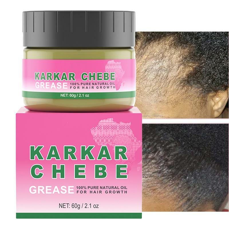 Huile de rehaussement de la croissance des cheveux, huile de karkar, anti-chute de cheveux, essence de réparation capillaire au romarin, revitalisant capillaire