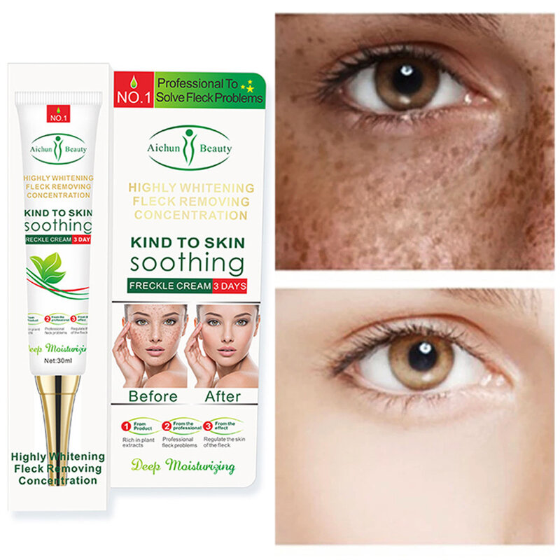 Remove Dark Spots Effective Whitening Freckles Cream Fade Melanin Anti-Pigmentation Improve Dullness Fast Brighten Skin Care