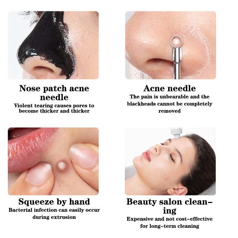 Facial Skin Scrubber Face Spatula Exfoliator Deep Cleansing Tool Blackhead Remover Pore Cleaner Body Skin Spatula Skin Care Tool