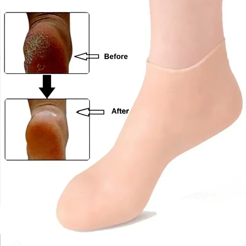 Skarpetki silikonowe Spa rękawice żel nawilżający skarpety złuszczające zapobiegające wysuszeniu pęknięte martwa skóra usuwają pielęgnacja dłoni stóp