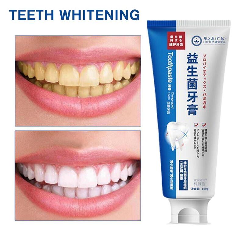 Sdotter-歯のホワイトニング,歯のホワイトニングのホワイトニング軟膏,100g,歯科医の修理,汚れの老化防止,2023 smil