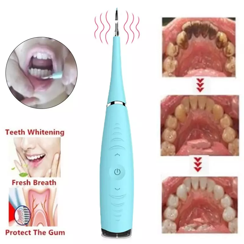 USB Recharge Vibração Sonic Dental Scaler, Dente Calculus Remover, Manchas de dente, Tartar Cleaner Tool, Whiten Dentes, Dropshipping