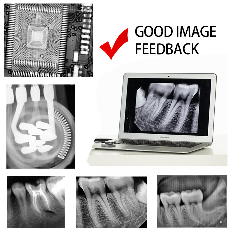 Mexico RU EU In Stock Greatlife Portable Dental X Ray Camera Original HyperLight X-ray Machine Wireless RVG Image Sensor System