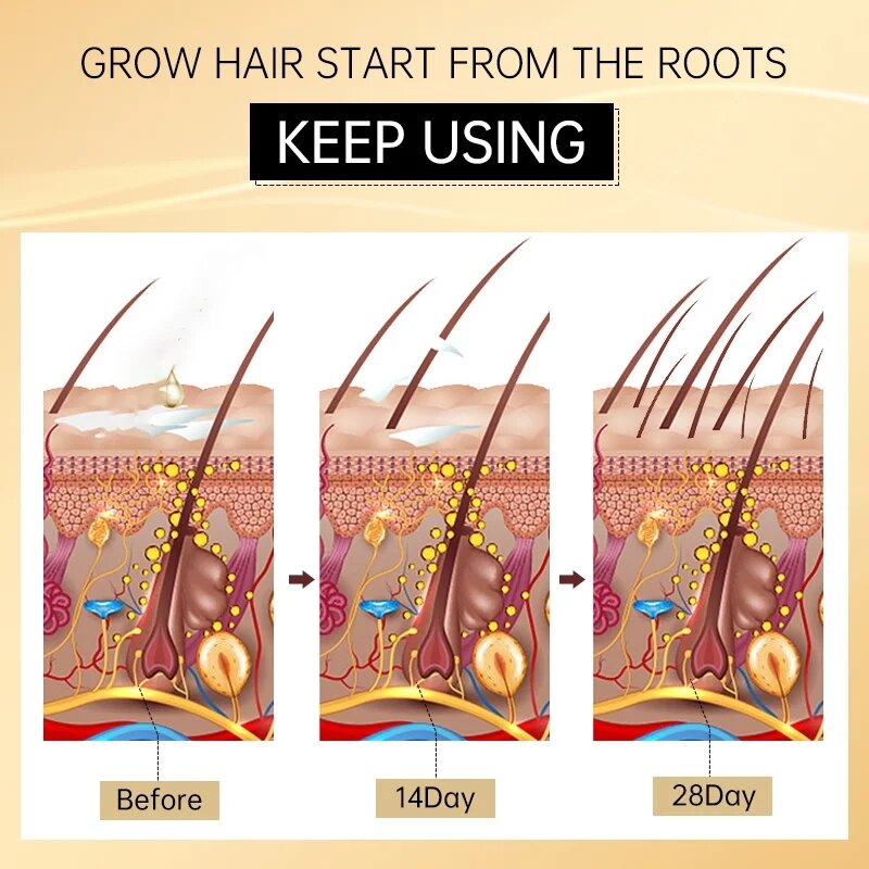 Ginseng Thickening Shampoo Hair Growth Products Men Women Ginger Essential Hair Loss Scalp Treatment Fast Grow Hair Care Beauty