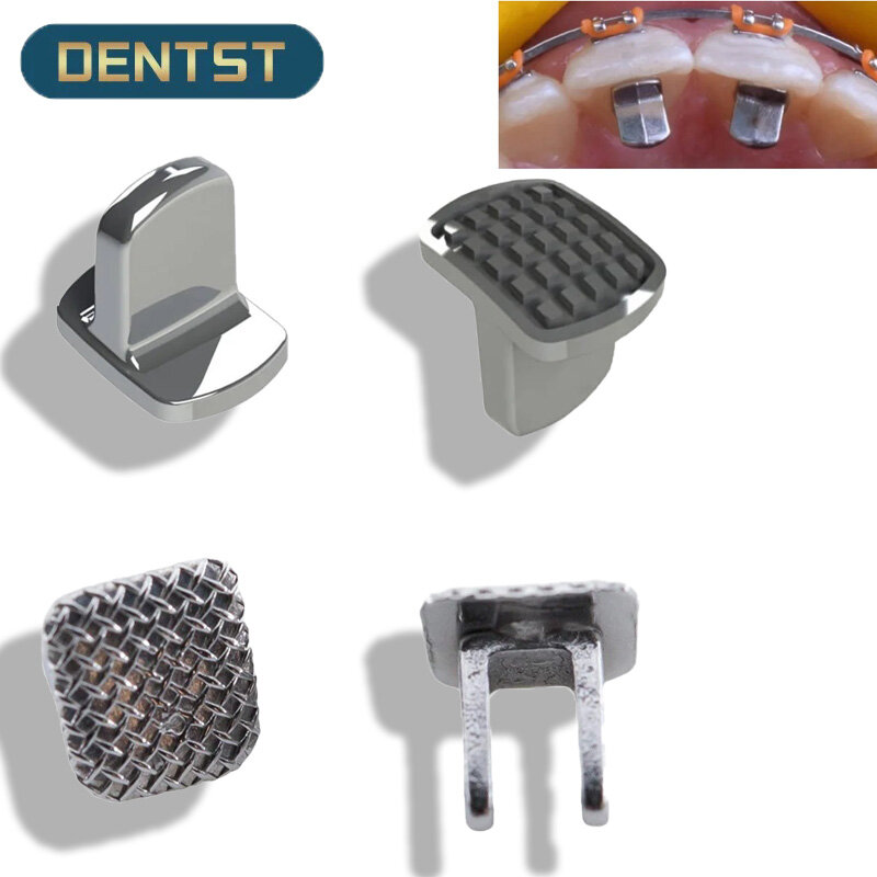 Dental Orthodontic Monoblock Bite Ramp, Mordida Abridor, único Wing Builder, Bondable Dobradiça, Tamers língua, 10pcs