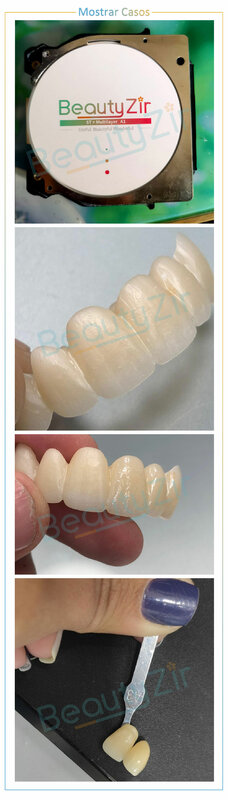 كتلة زركونيا متعددة الطبقات للأسنان ، سوبر الشفافية ST و ML ، 95 ، من من من من من من
