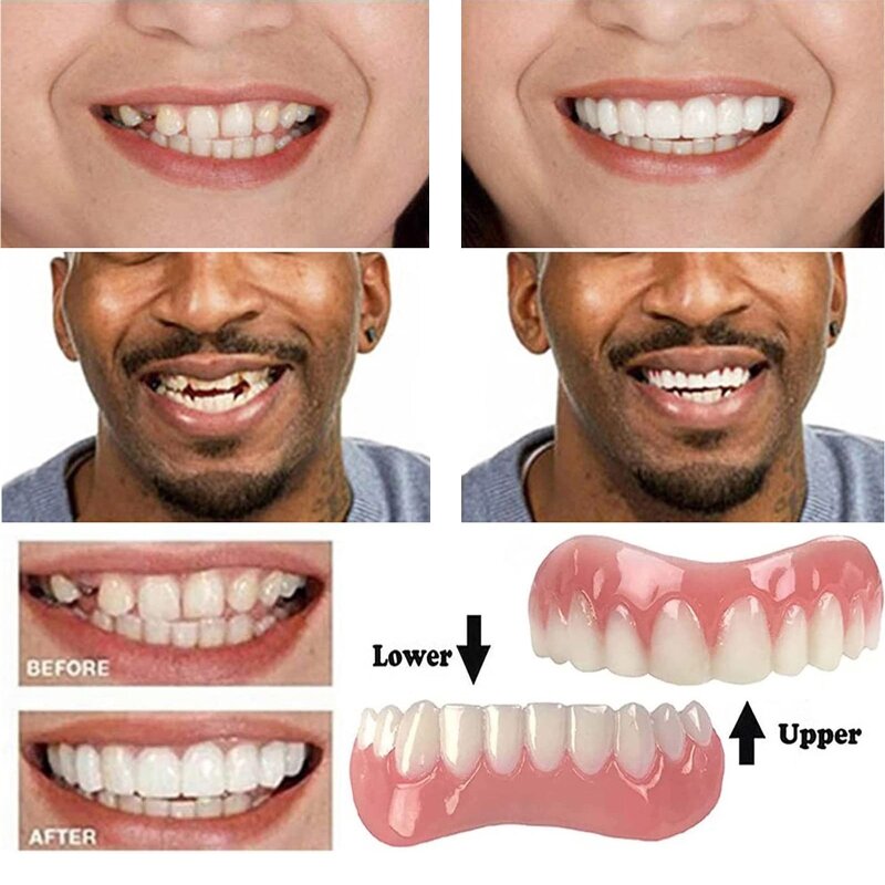 50LD Falsche Zähne Silikon Oberen Unteren Veneers Perfekte Lachen Veneers Zahnersatz Paste Gefälschte Zähne Hosenträger