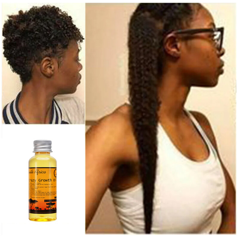 50 ml di olio di Layden africano prodotto con metodi antichi coltiva i capelli più velocemente più a lungo Stop rottura idratante promuove la crescita dei capelli