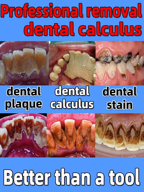 Pasta gigi pemutih gigi, pasta gigi penghilang kalkulus gigi, penghilang bau mulut, pasta gigi pencegah noda darah, pasta gigi fluorida