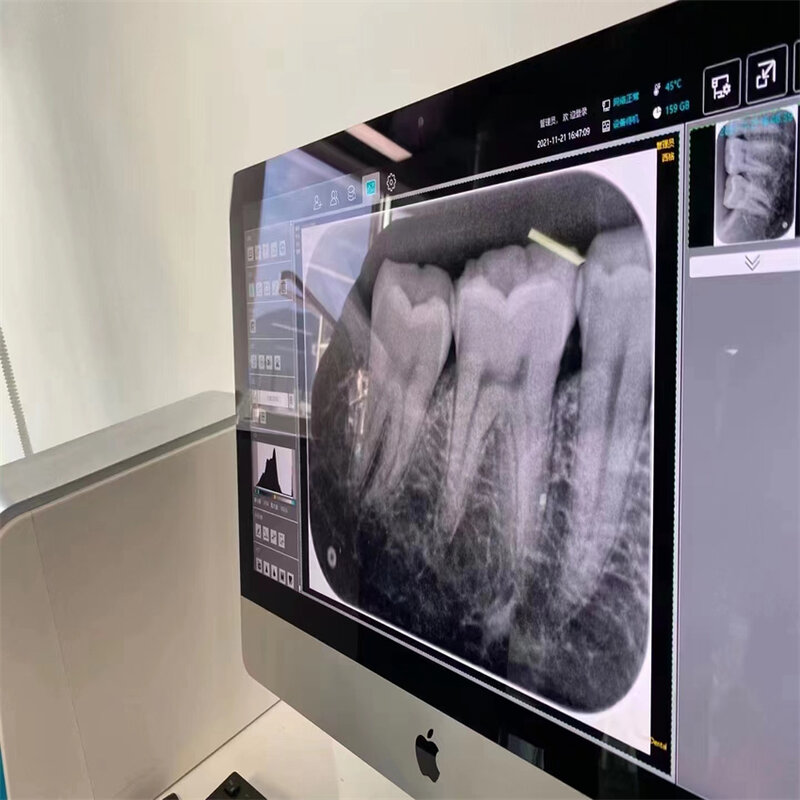 デジタル歯科用X線機器、タッチスクリーンパッド、医療機器、診療所用のX線フィルムユニット、工場用品