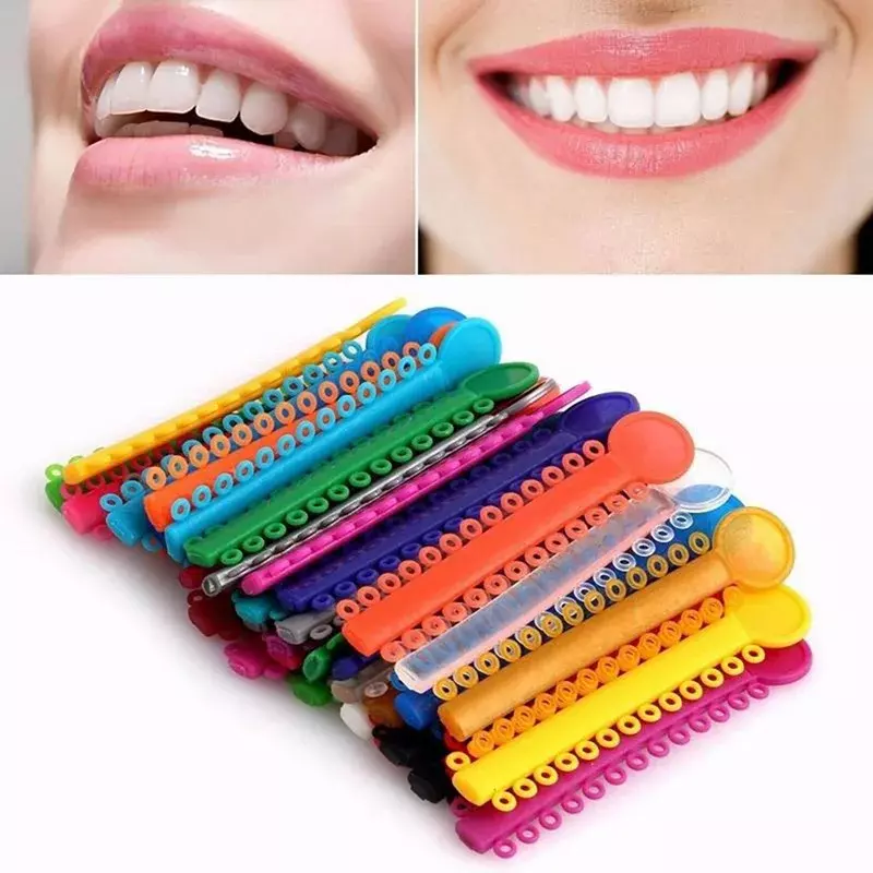Ligaduras elásticas para ortodoncia Dental, módulos de ligadura elásticos multicolores, materiales dentales, 40 unids/lote por bolsa