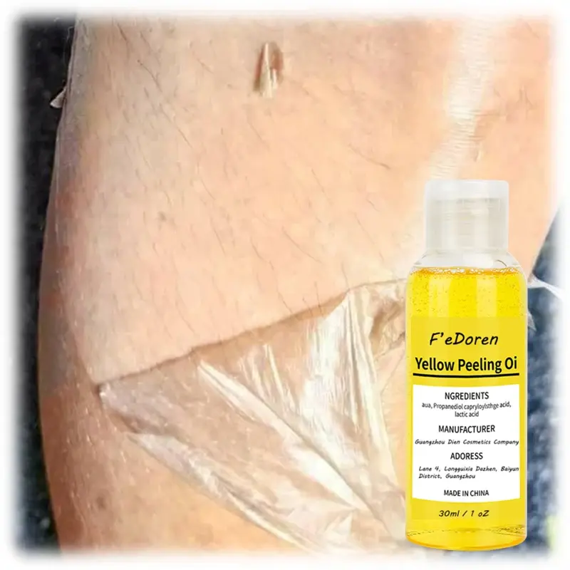 30/50ml Thai yellow peeling oil sbiancamento della pelle scura retinolo con macchie di peptidi punti neri macchie trattamento delle macchie della pelle cattiva