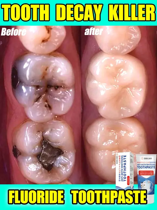 Le dentifrice fruité le plus vendu protège les gencives et prévient la carie dentaire