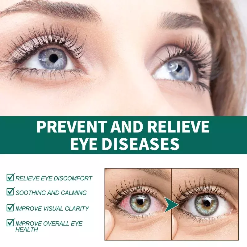 Eye acupoint roller relax alleviare l'affaticamento degli occhi protezione dal prurito secco visione rimuovere la seta del sangue rosso prevenire la miopia cura del massaggio degli occhi