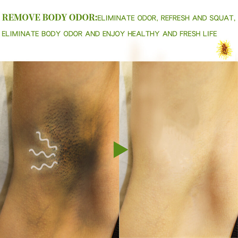 1~10PCS 20ml Body Odor Sweat Deodor Spray Lasting Body Underarm Feet Sweating Deodorizer Eliminate Bad Smell Antiperspirants
