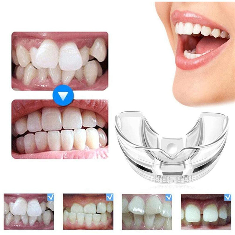 실리콘 치아 투명 교정 세트, 치과기구 치아 리테이너 마우스 가드 교정기, 치아 트레이, 치아 관리 도구, 3 단계