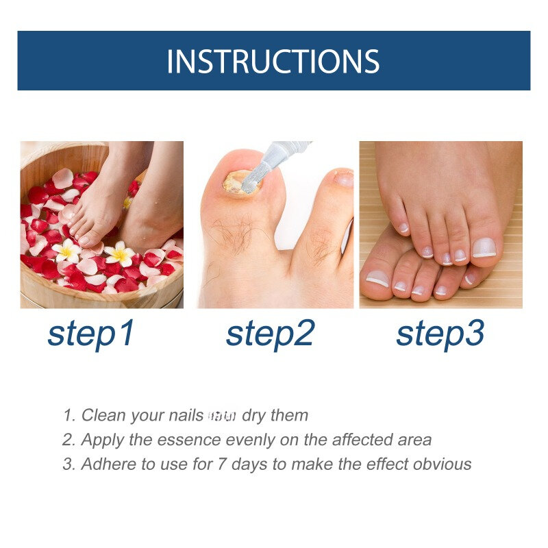 Эссенция для восстановления ногтей на 7 дней, средство для лечения грязных ногтей и лечения грибка, осветления онихомикоза, противоинфекционный раствор для ухода за ногтями