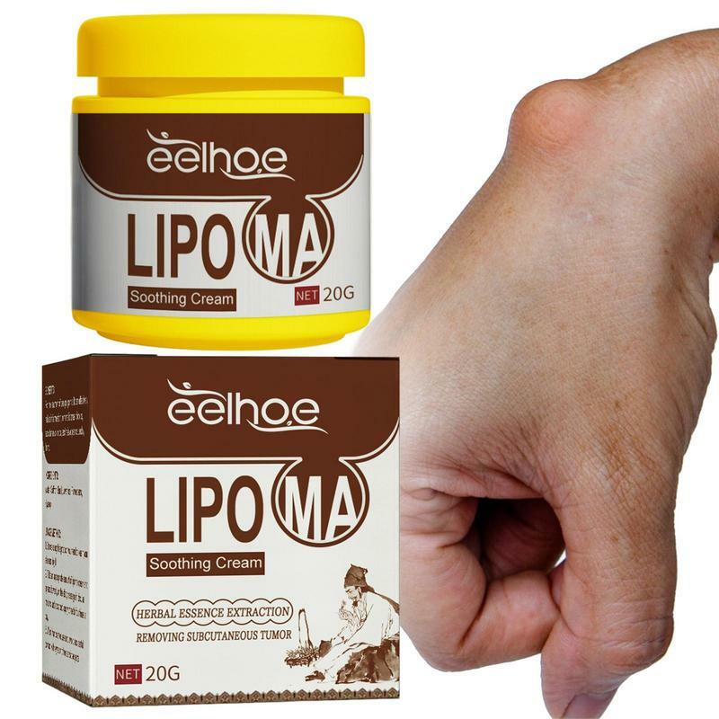 Lipoma Removal Cream 20g Relief Pain Treat Skin Swelling Lipolysis Cellulite Fat Lump Nodule Removal Smoothing Cream
