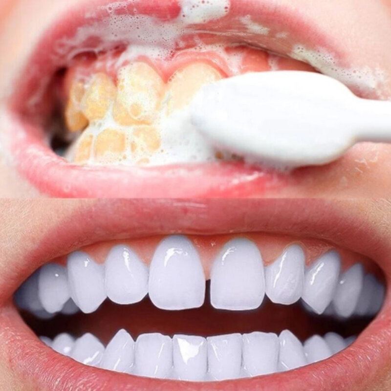 Dentifricio al carbone pulizia orale sbiancamento cura dentale rimuovere macchie di placca tartaro denti correttore di colore alito fresco 100g