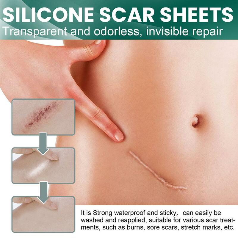 Rouleau de gel de silicone pour retrait de cicatrices chirurgicales, patch autocollant, ruban adhésif, réparation de la peau, salle de bain, 1 pièce