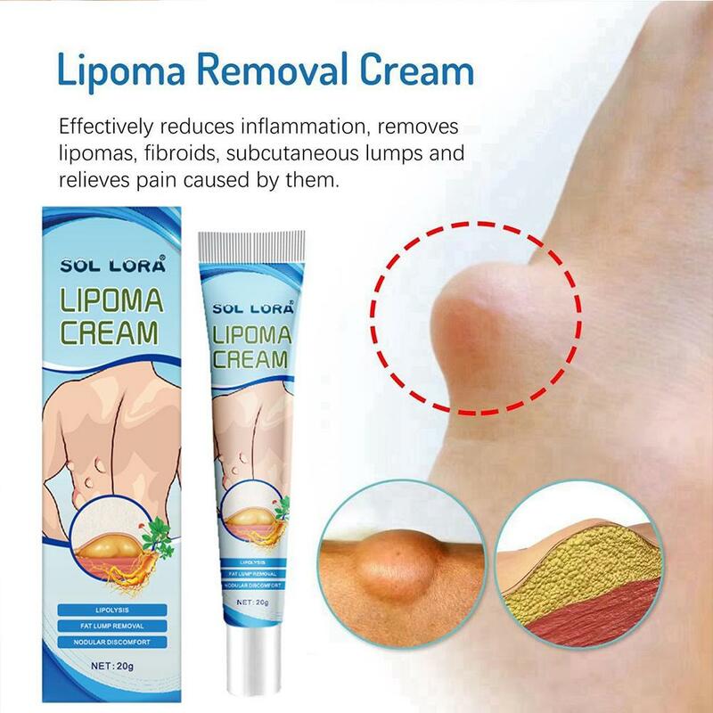 LOT Lipoma Ointment Effectively Removal Lipoma Fibroids Cream Body Cream Dissolving Fat Easy To Use Herbal Lipoma Removal Cream