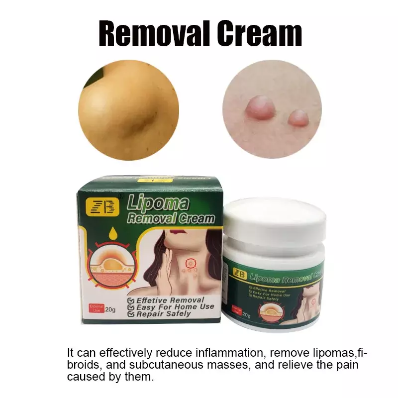 4pcs Care Cream Lipolysis Fat Lump Relief Plaster Anti-Tumor Skin Swelling Remove Cellulite Chinese Herbs Plaster