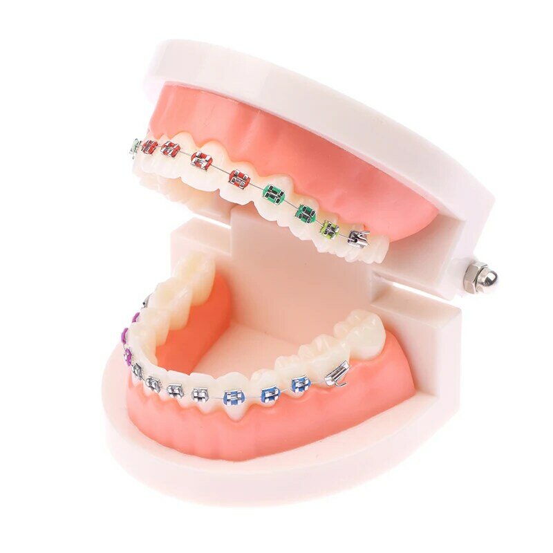 Tandheelkundig Orthodontisch Model Tandheelkundig Model Tandheelkunde Orthodontische Tanden Model Met Haakjes Voor Tandarts Studie Patiënt Demo