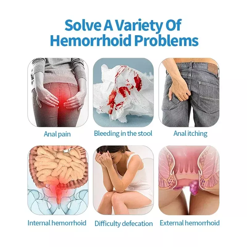 Hemorrhoids Treatment Medical Spray Piles Pain Cure Anal Fissure Removal Intemal External Hemorrhoid Health Medicine 2/4Bottles