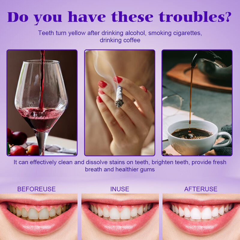 Dentes branqueamento creme dental roxo, Mousse Dental Care for Teeth, White Brightening Tooth Care, reduzir amarelecimento, 30ml, Novo