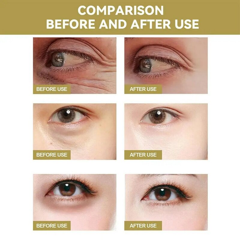 1/2 stücke Hyaluron säure Mikron adel Augenklappen Maske für Anti-Falten-Alterung Augenringe feuchtigkeit spendend unter Augen gel Pads Haut