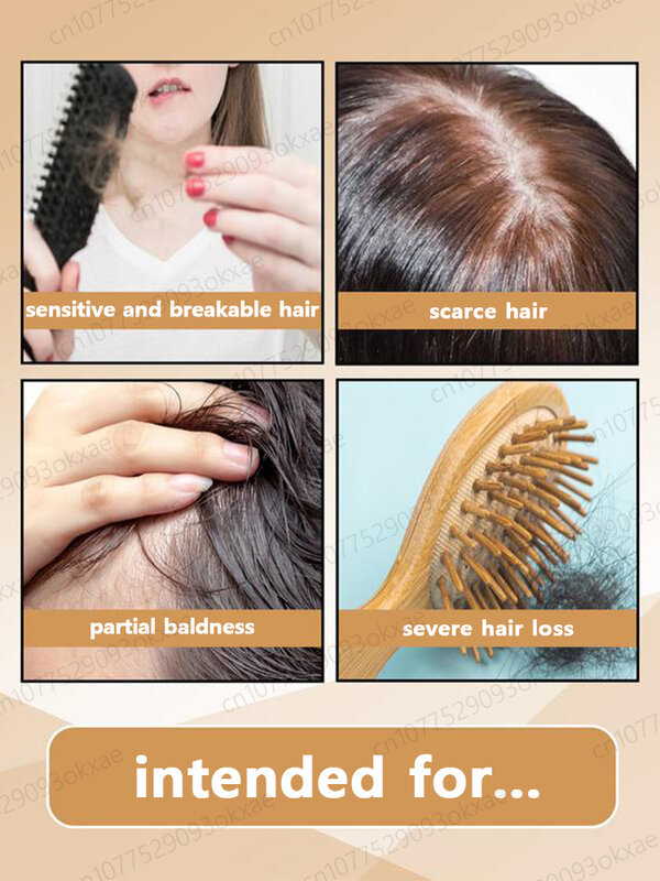 男女兼用 迅速かつ効果的な脱毛修復治療 遺伝的な脂漏性脱毛症対策 ヘア成長エッセンシャルオイル製品