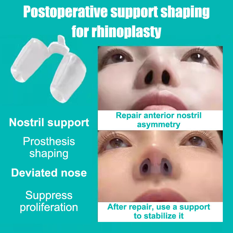 Послеоперационная опора для ноздрей, силиконовый фиксатор для коррекции искривления носа, силикагелевый зажим для носа