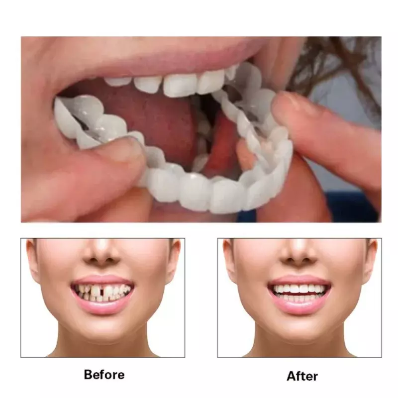Capa de dente falsa ajuste perfeito para clareamento dos dentes, Snap em facetas de silicone sorriso, Dentaduras Flexibles, beleza ferramenta cosmética