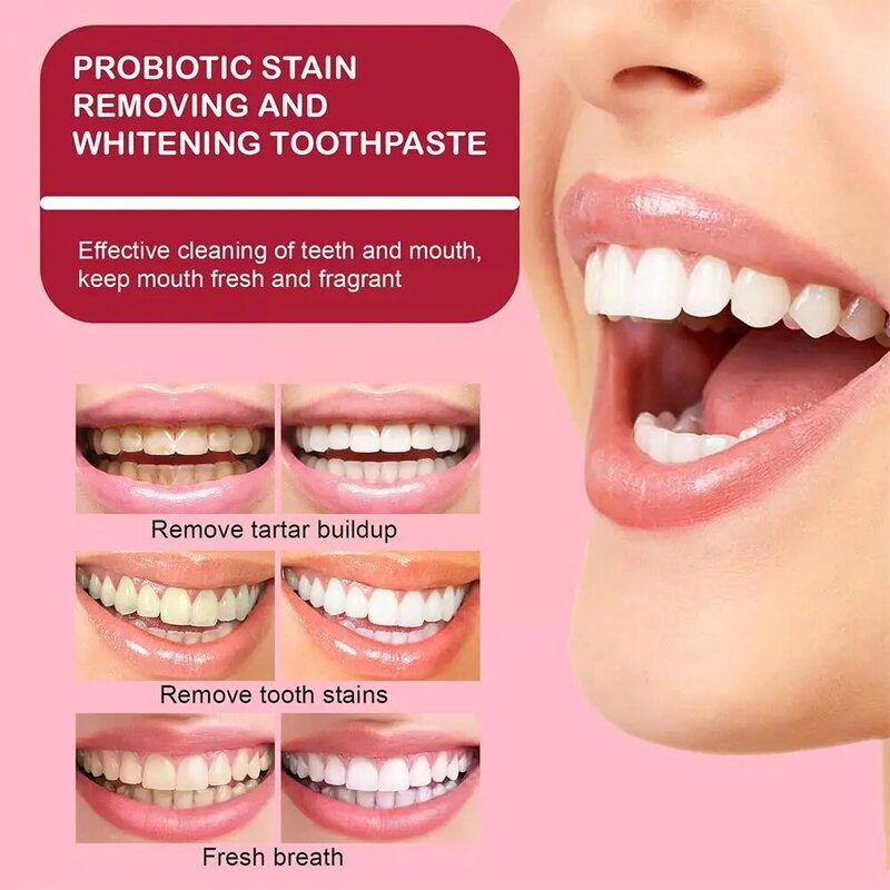 Pasta gigi pencerah probiotik 30ml pasta gigi perawatan mulut napas Oral membersihkan segar mencegah plak E7B3