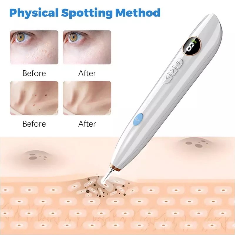 9 Mode Plasma Pen Freckle Remove Pen Wart Remover Mole Tattoo Remover Instruments Skin Tag Removal Spot Cleaner Beauty Care Tool