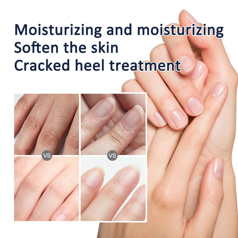 Herbal Anti Dry Crack Hand Foot Cream Repair rimozione di screpolature del tallone esfoliazione cura dei morti ammorbidente idratante mano gamba bellezza