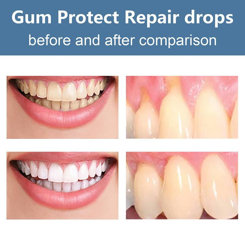 Gomme Protect Gum Repair Drops, Gomme de Charleroi, Gonflement des dents buccales, Retirer les livres dentaires, Soin blanchissant jaune, A3P3, 30ml