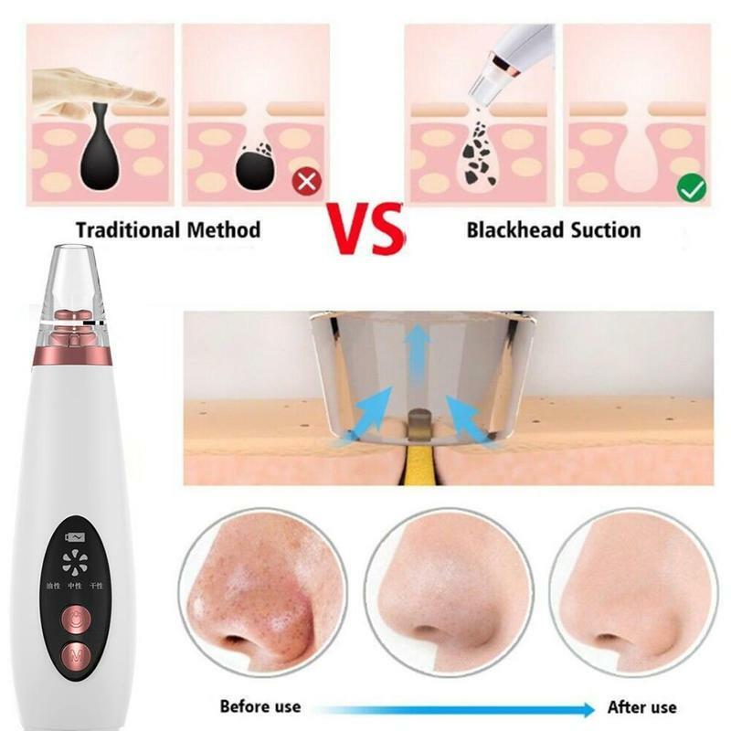 USB Rechargeable Blackhead Remover Face Pore Vacuum Skin Care Acne Pore Cleaner Pimple Removal Vacuum Suction Tools