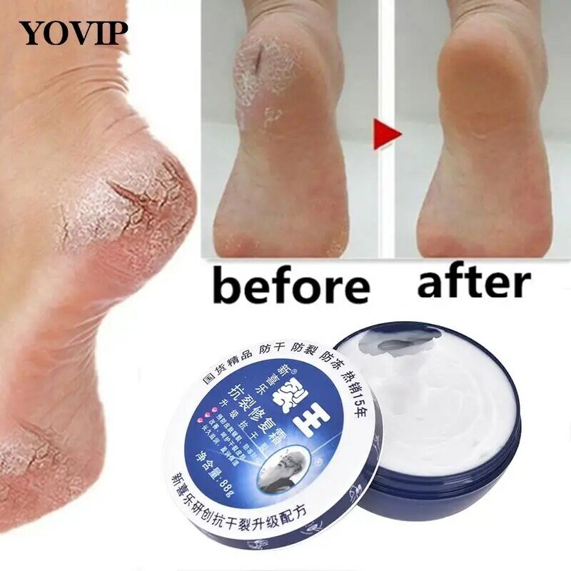 1Pcs มือเท้า Crack ครีมส้นเท้าแตก Peeling Anti-แห้งซ่อมชุ่มชื้นกำจัดผิวหนังที่ตายแล้วมือ Care เท้าหน้ากาก