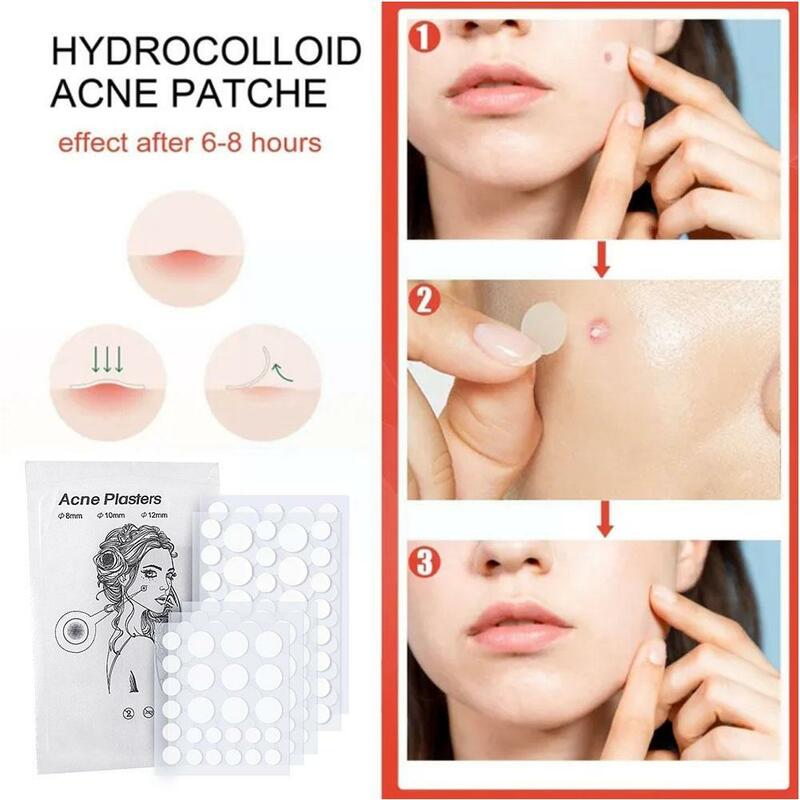 Invisible Concealer Acne Print Patch Transparent Hydrocolloid Patch 24/36 Acne-covering Invisible Invisible Acne-covering P I2K3